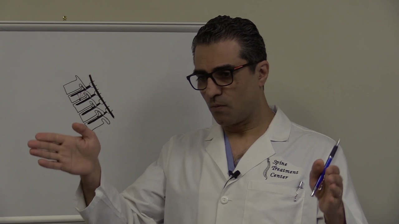 Biomechanics of pedicle screw and how they fail