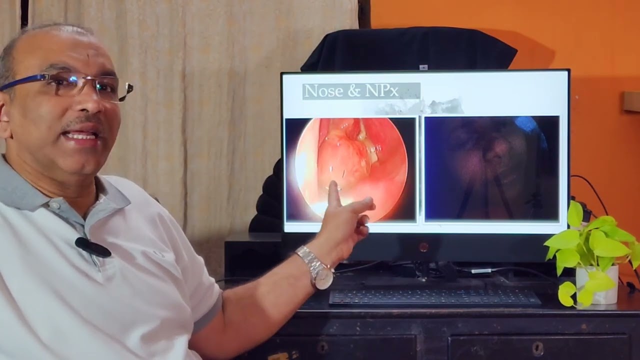 Halitosis / bad breath. Malayalam. Patient teaching programme.