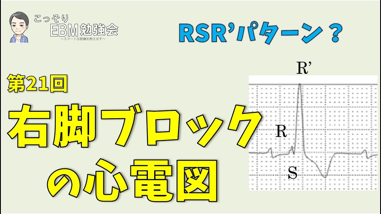 【心電図】第21回　分かる！右脚ブロックの心電図