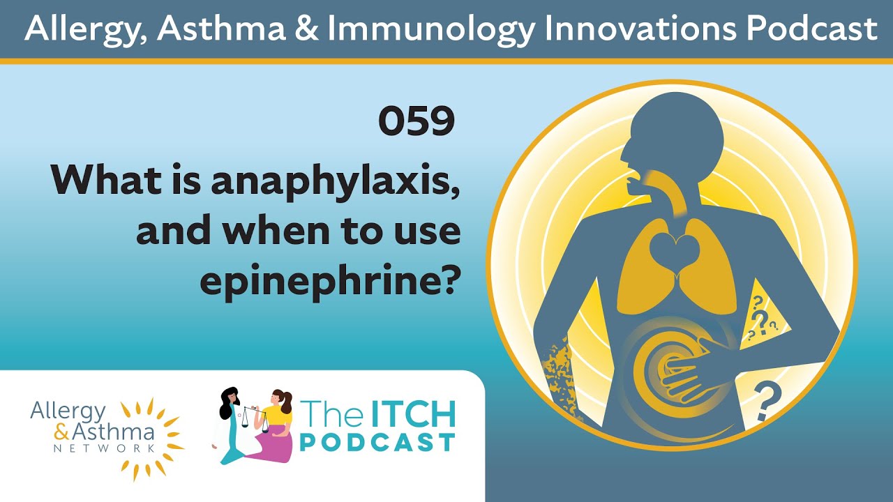 What is anaphylaxis and when to use epinephrine?