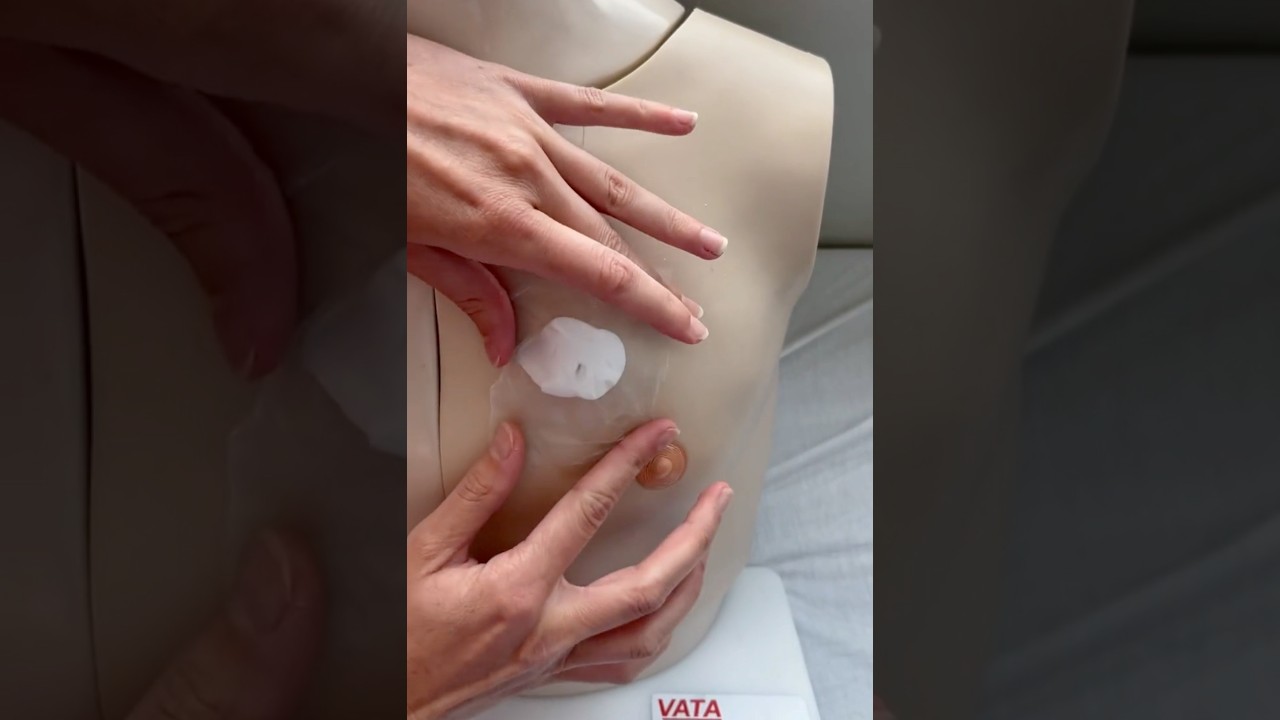 How to Apply Lidocaine Cream Before Port Access