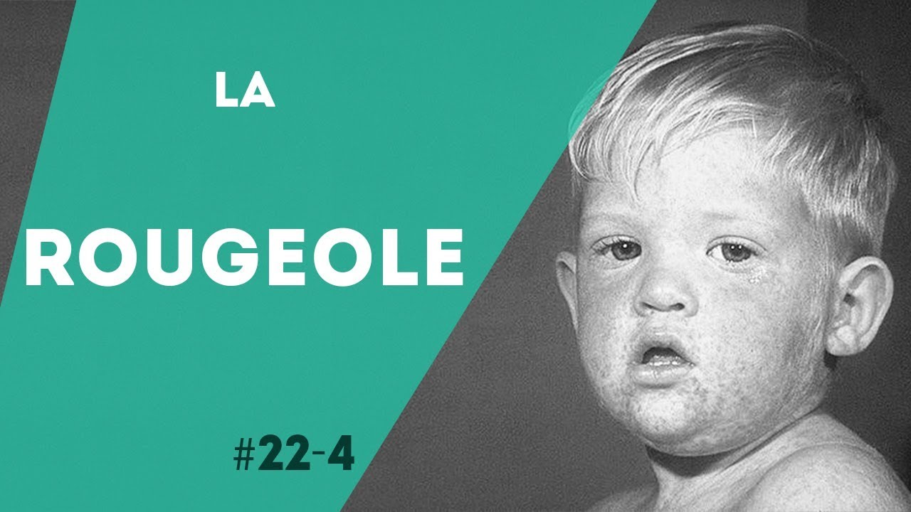 PNN 22.4 - La Rougeole