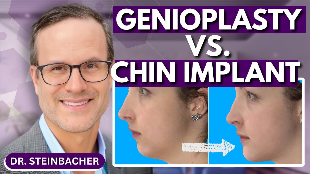 Genioplasty vs. Chin Implant: Which Is Right for You? | Dr. Steinbacher's Insight