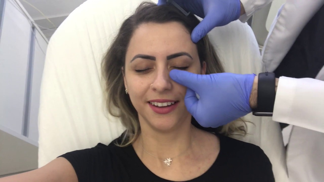 VLOG - Fiz preenchimento de olheiras | Jack | 