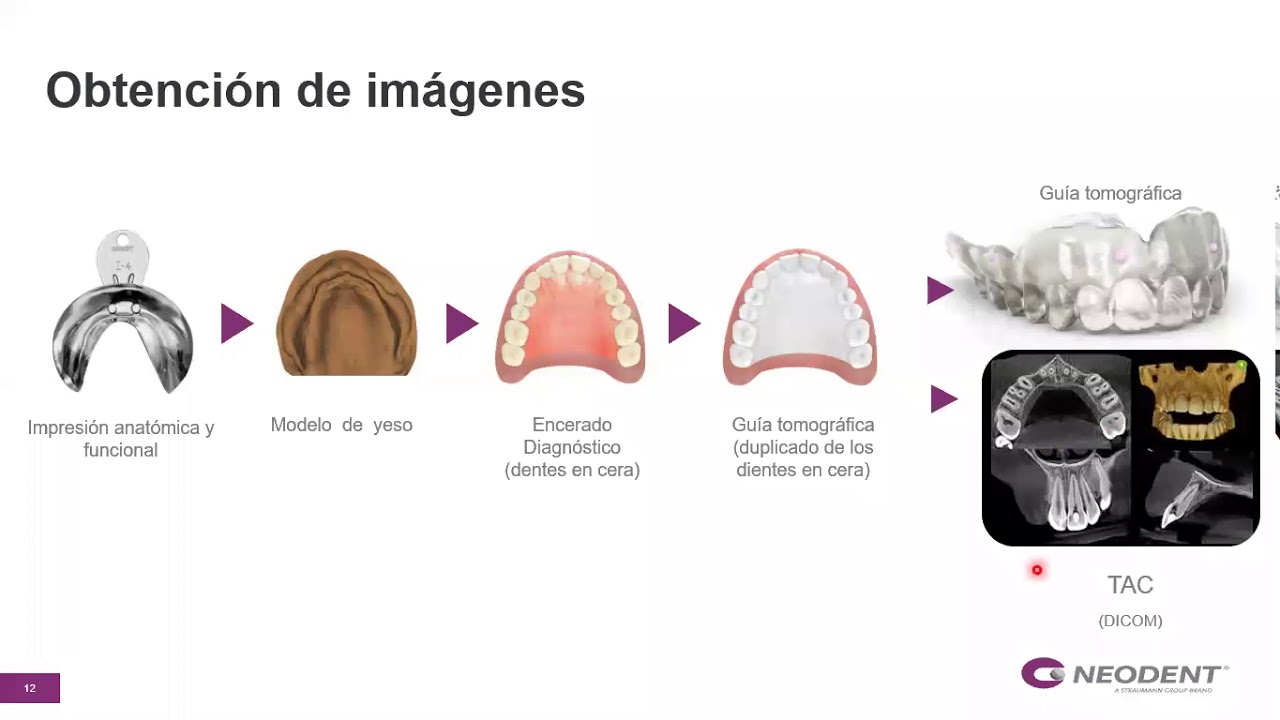 Cirugia Guiada CM, Nuevo enfoque en planificación