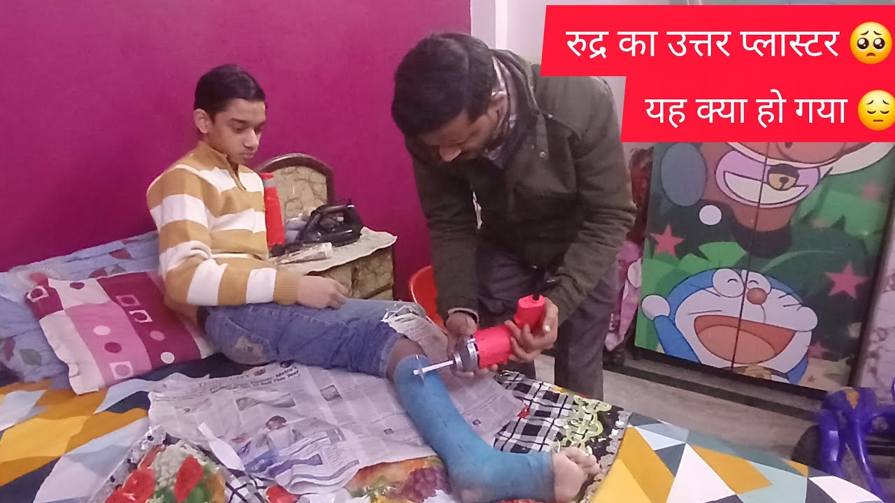 3 महीने बाद उत्तर रुद्र का प्लास्टर देखकर मन भर आया 🥺