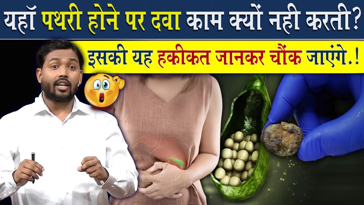 शरीर में इस जगह पथरी होने पर डॉक्टर बिना ऑपरेशन के ठीक क्यों नहीं कर पाता?