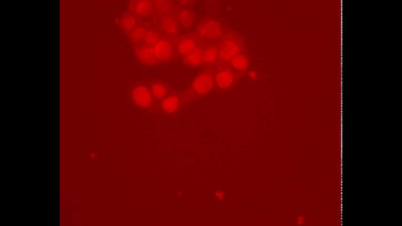 S100p-mCherry translocation to nucleus