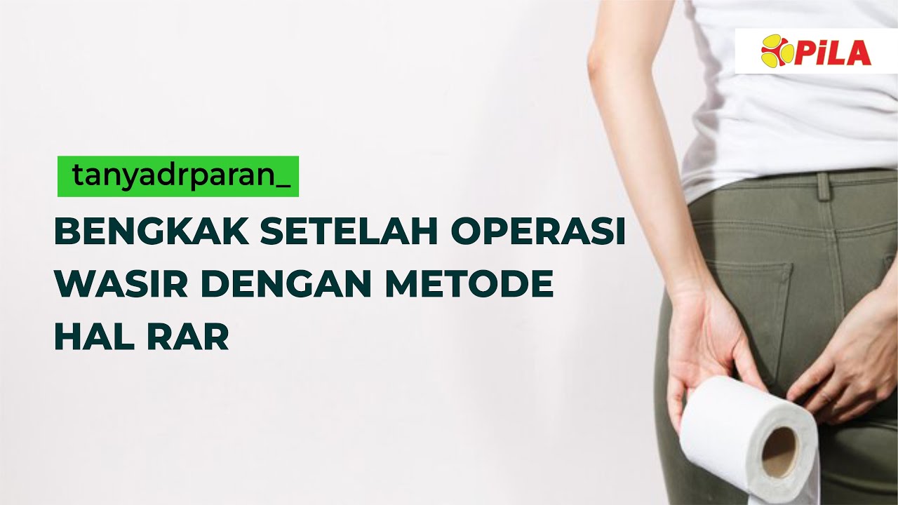 bengkak setelah operasi wasir dengan metode HAL RAR