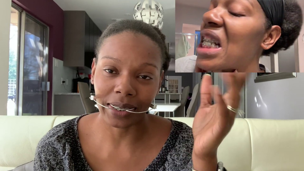 Braceface Chronicles - Headgear Causes Underbite?!