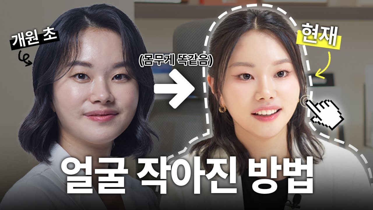 소두에 집착하는 의사가 직접 1년 동안 해보고 증명한 얼굴형 관리 시술 루틴