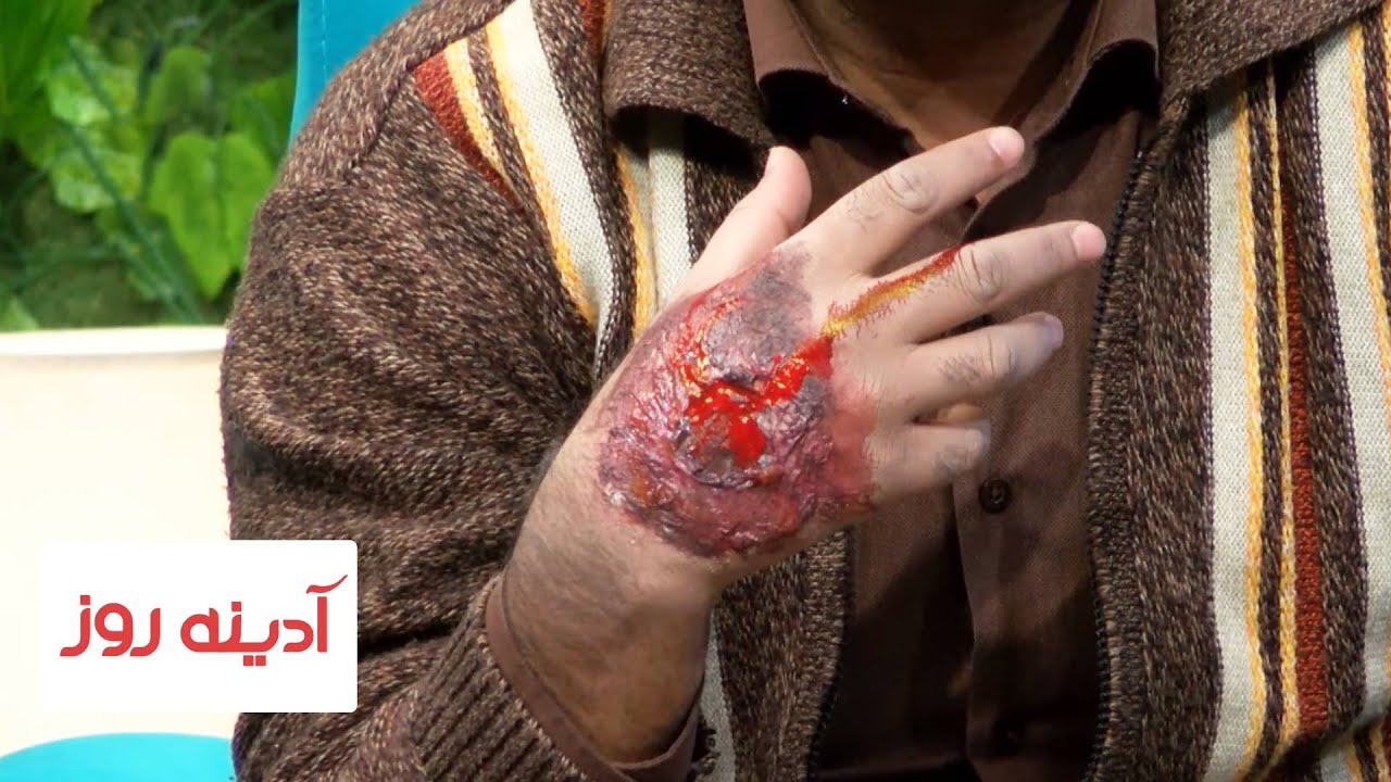 مجروح شدن صمیم رهنورد توسط فواد گلبرگ