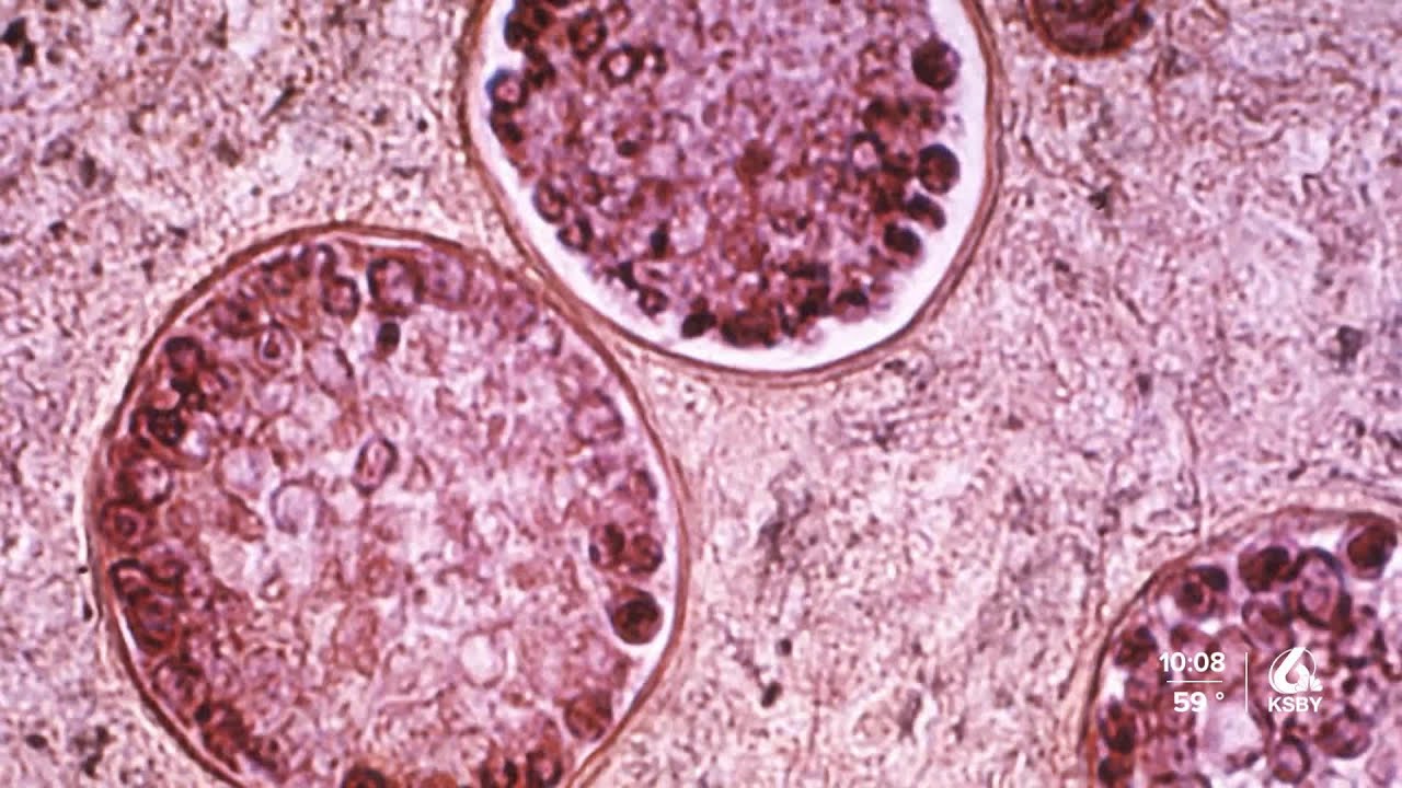 SLO Co. sees highest ever number of Valley Fever cases but it's 'not unexpected,' officials say