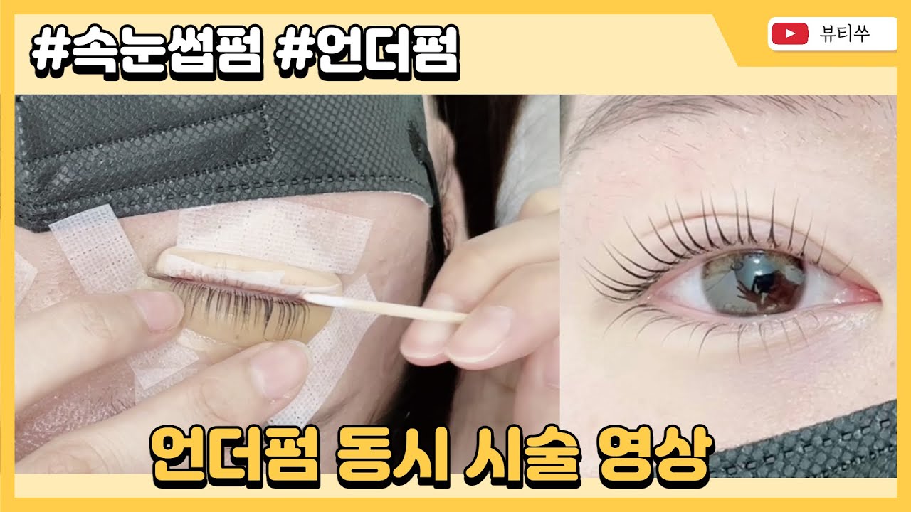 속눈썹펌, 언더펌 동시시술ㅣ왕관롯드M, 로만사언더롯드