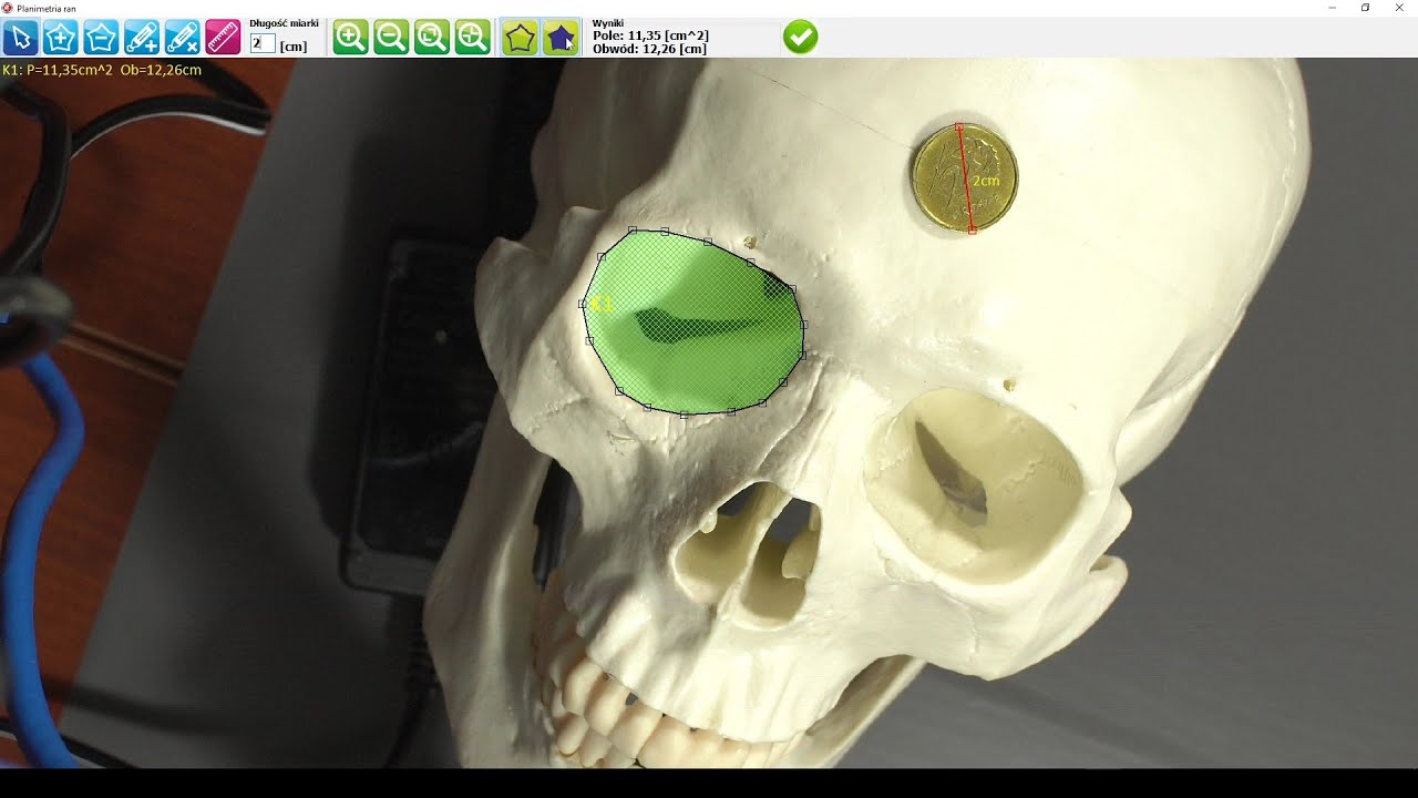 ALFA STUDIO Planimedica 2D, planimetria 2D