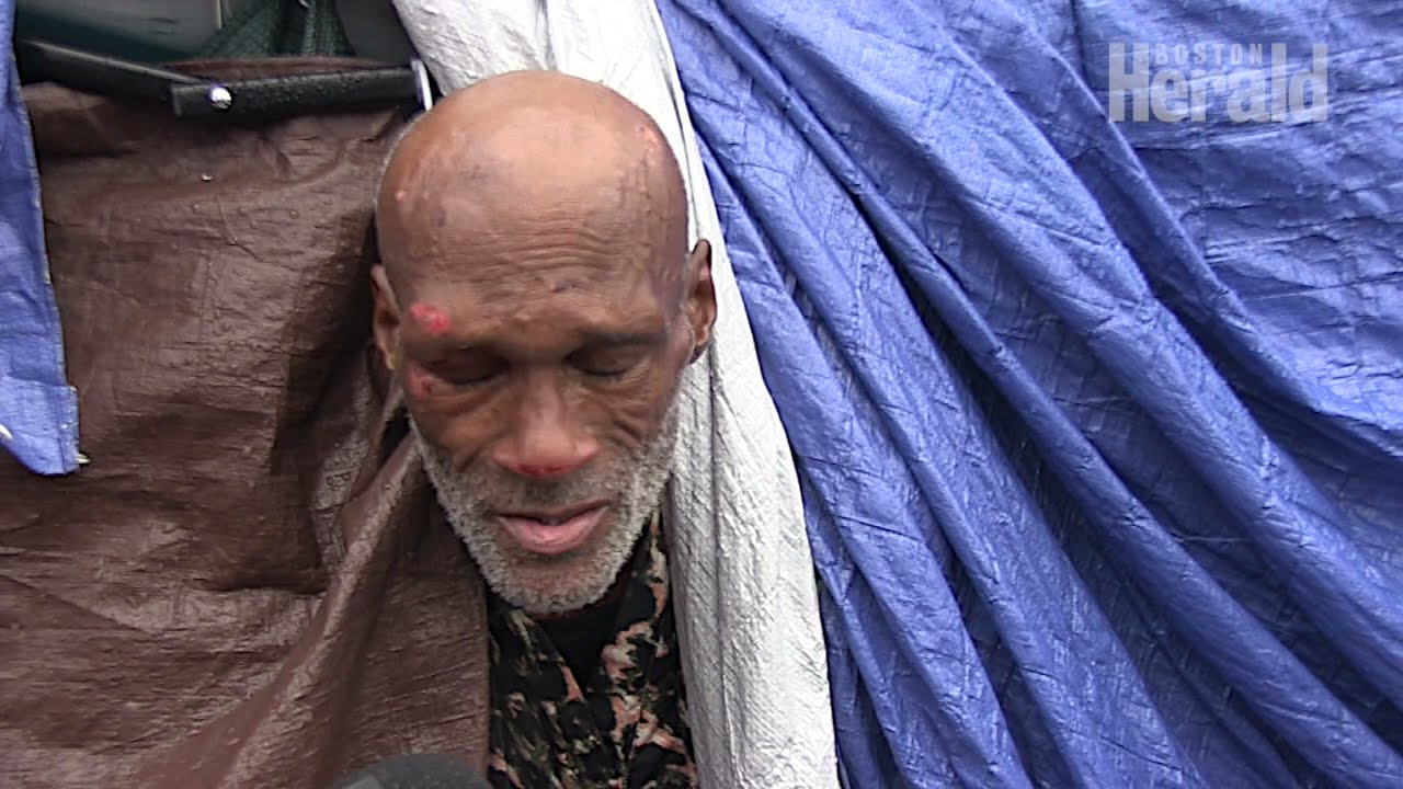 Boston city officials start clearing out homeless encampments at 