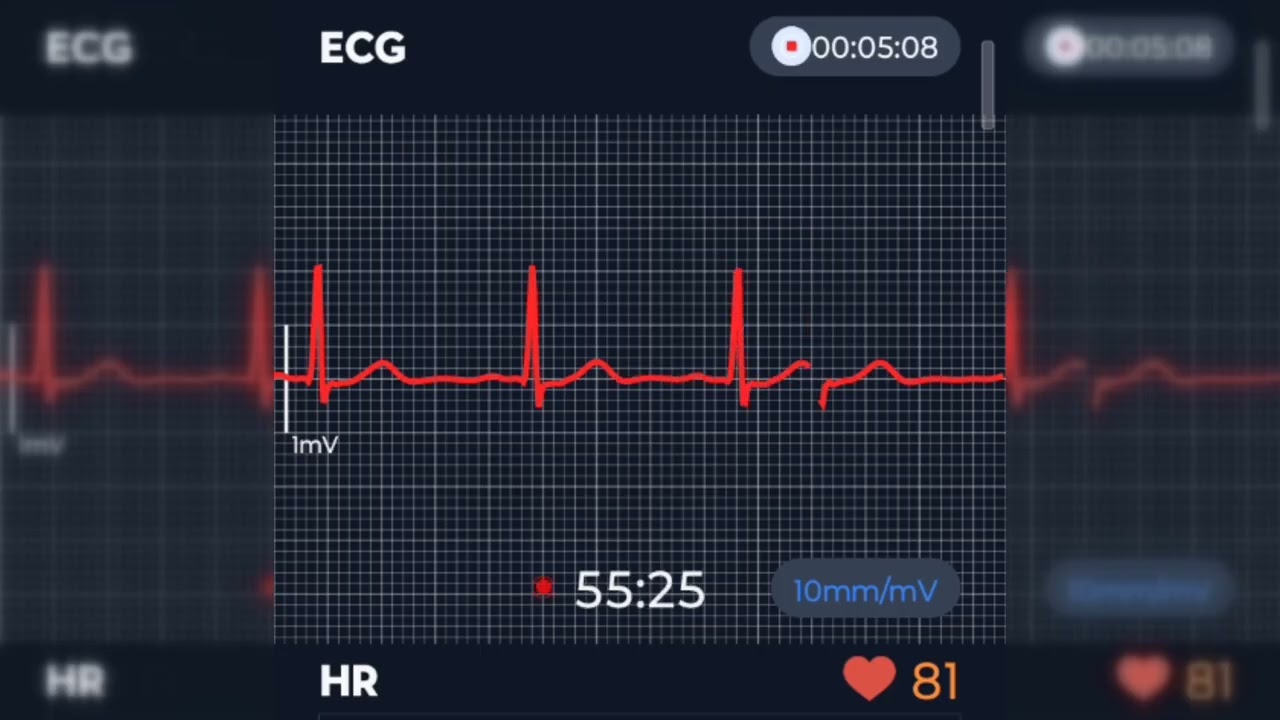 Anxious White Wolf's Relaxed Resting Heartbeat