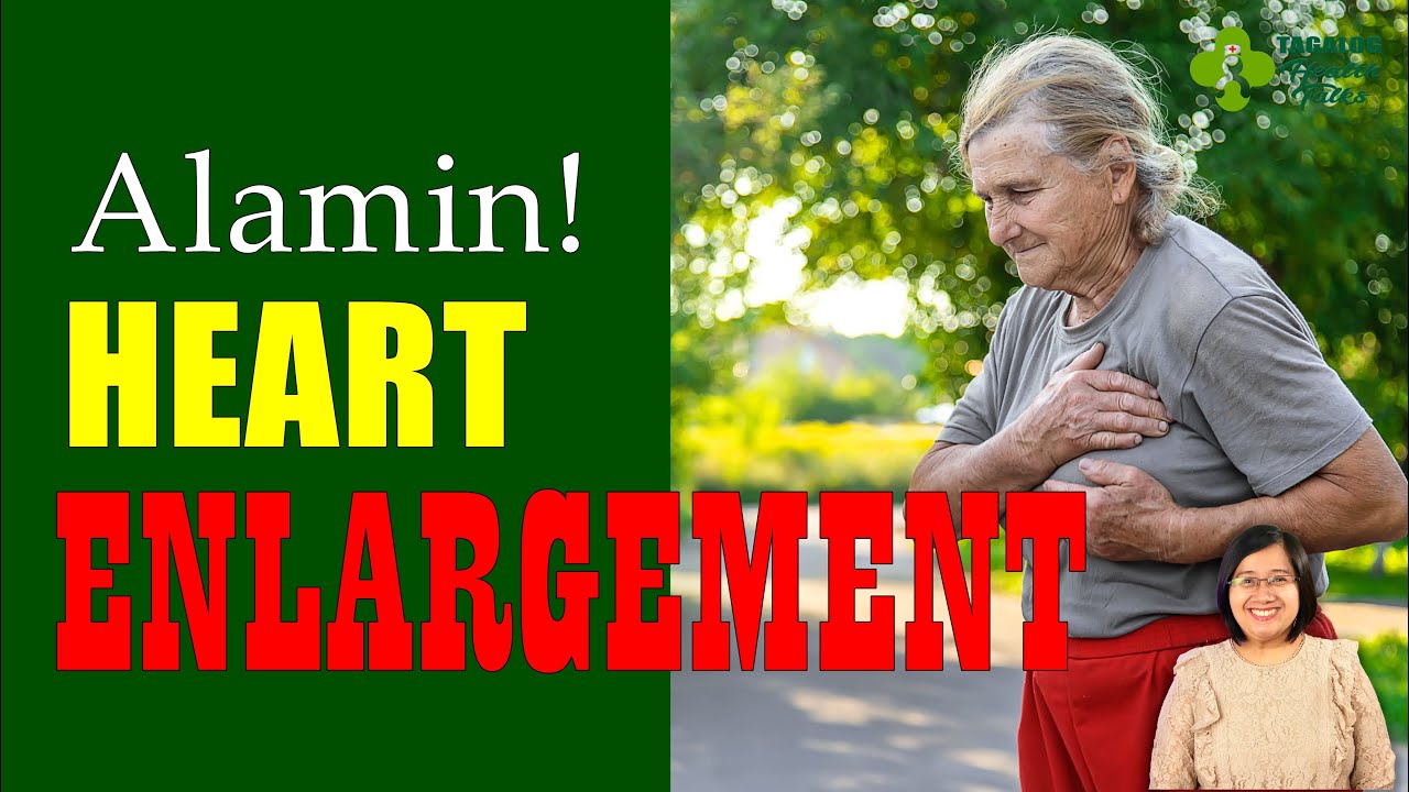 Ano ang CARDIOMEGALY ~ Babalik pa ba sa normal kapag uminom ng GAMOT? Tagalog Health Tips