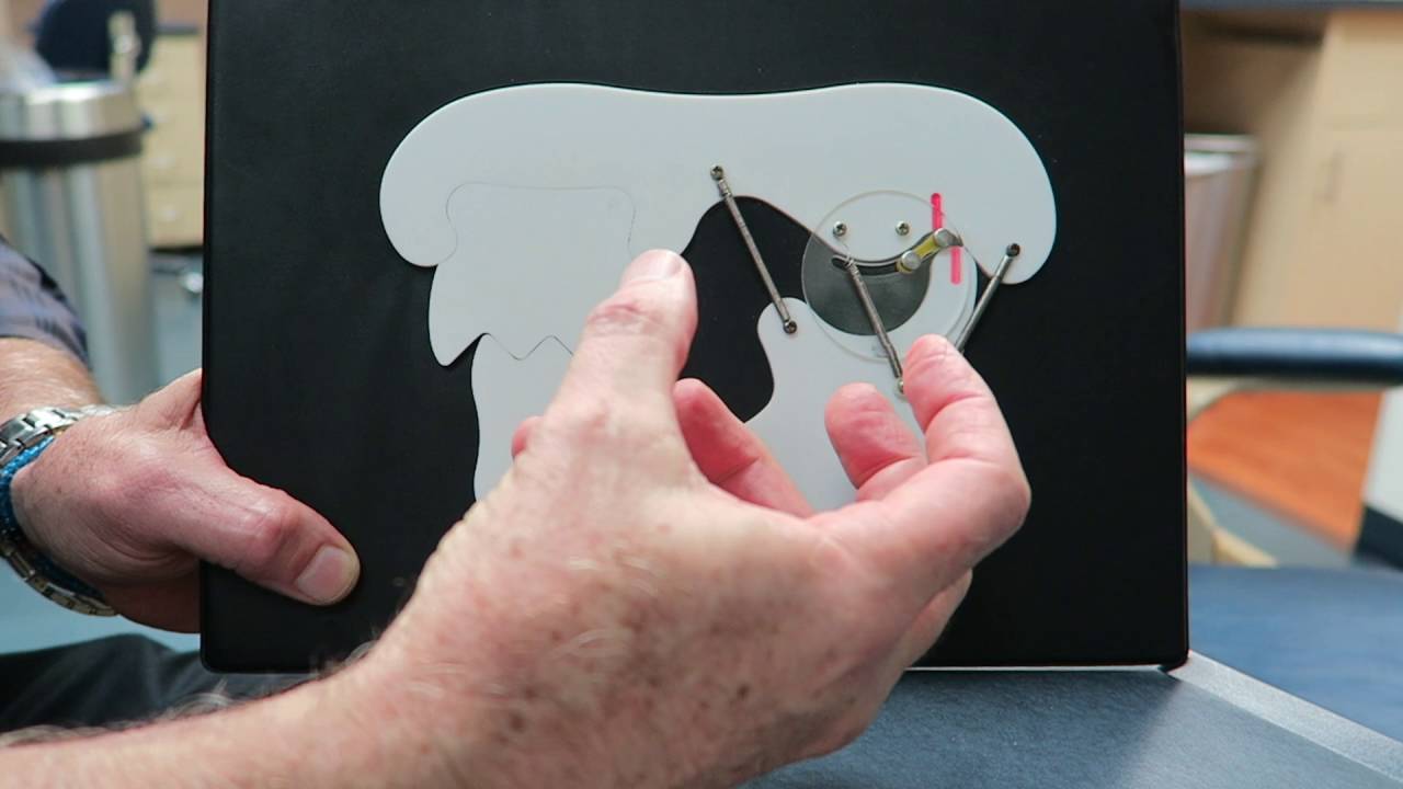 What is TMJ?