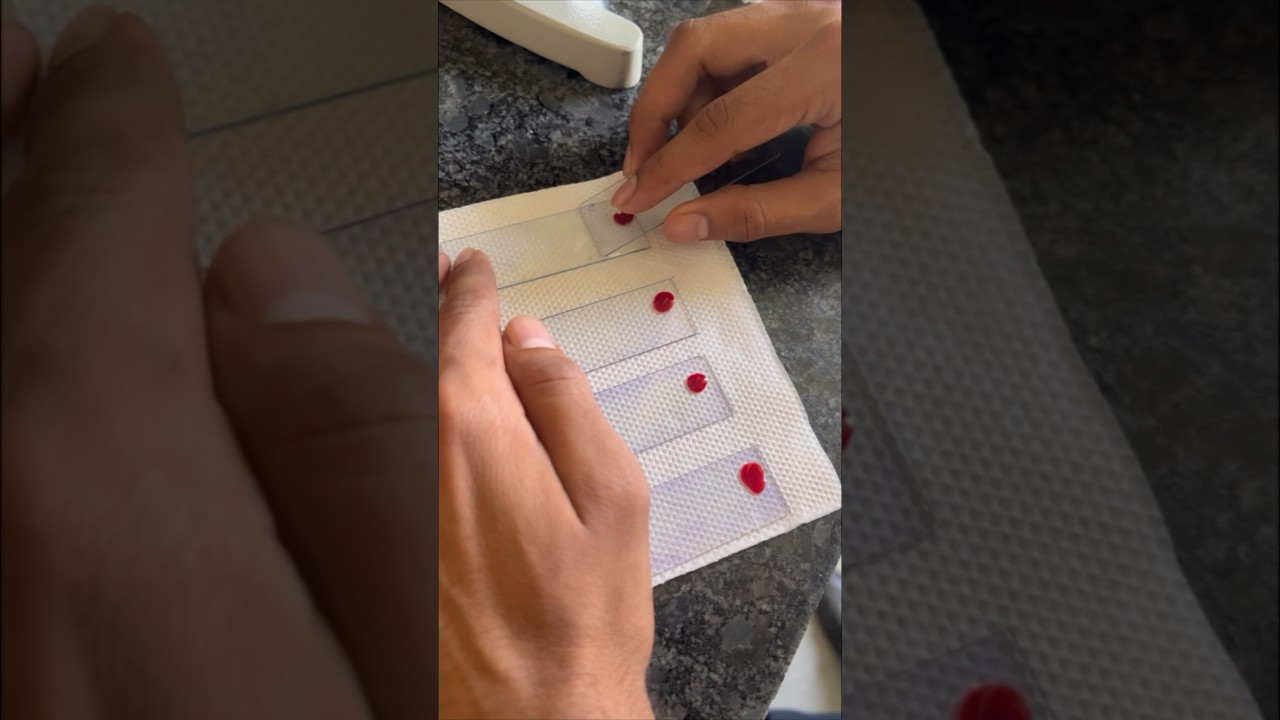 DLC Blood smear🩸| full process | Mbbs life | ilahi | #mbbslife #dlc #ilahi #practical
