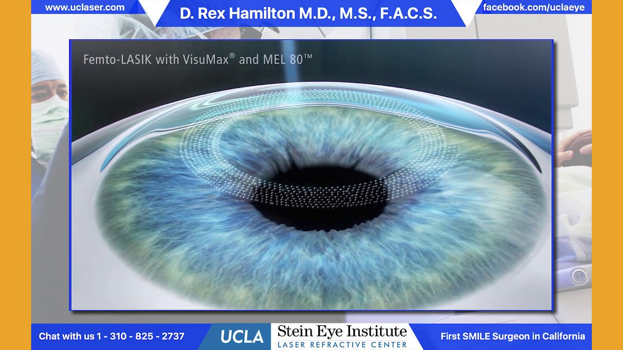 PRK, LASIK, SMILE: What's the Difference?