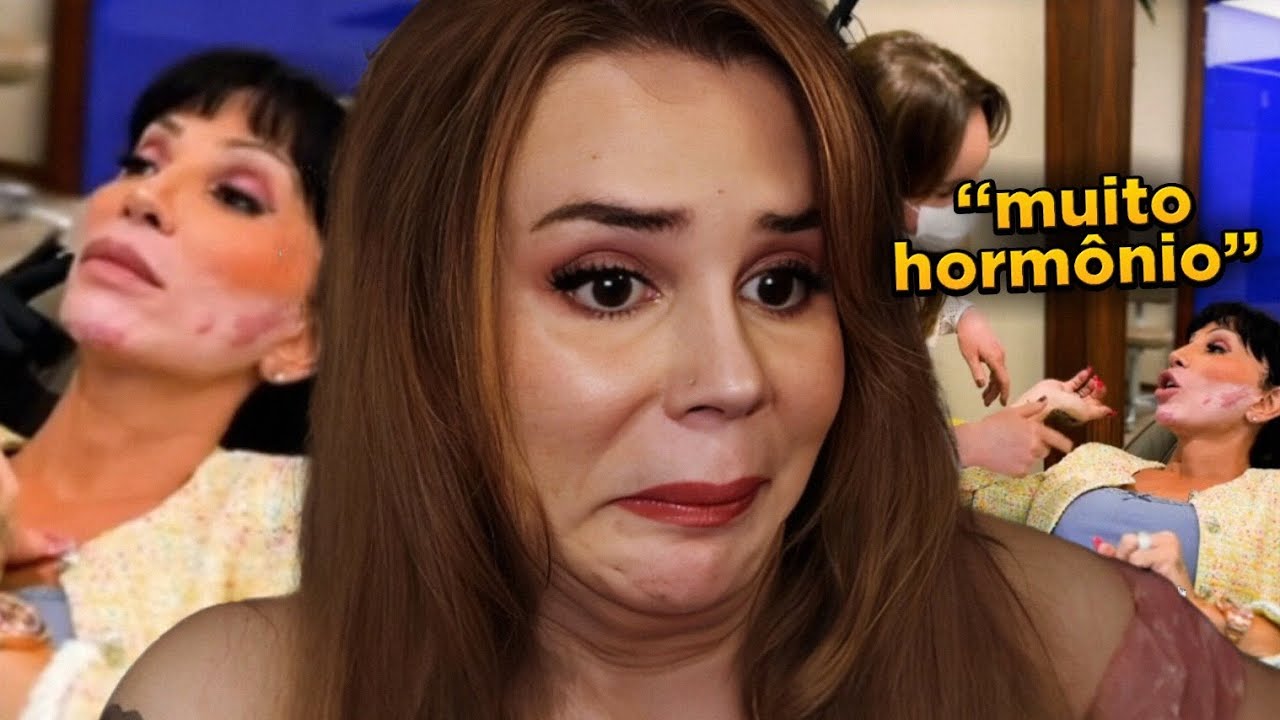 Maya Massafera mostra SEQUELAS do PEELING DE FENOL 😨 culpa dos hormônios?
