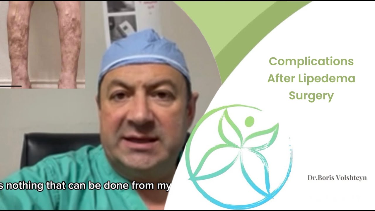 Complications After Lipedema Surgery Part 2 - Dr. Volshteyn