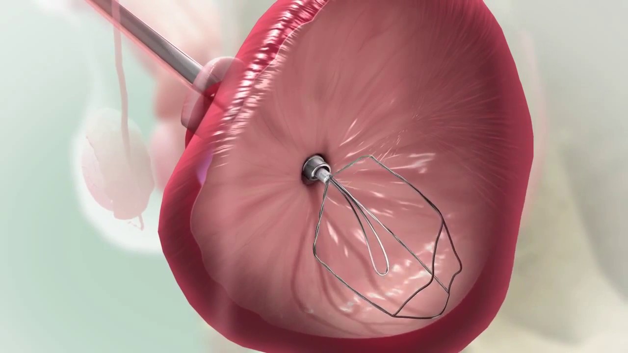 innoMedicus Medi Tate iTIND October 2015 720p