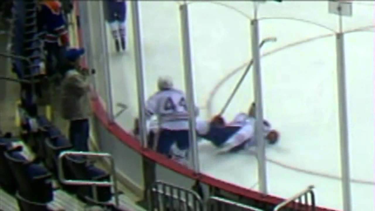Taylor Hall is cut in the face by a skate in the warm up.