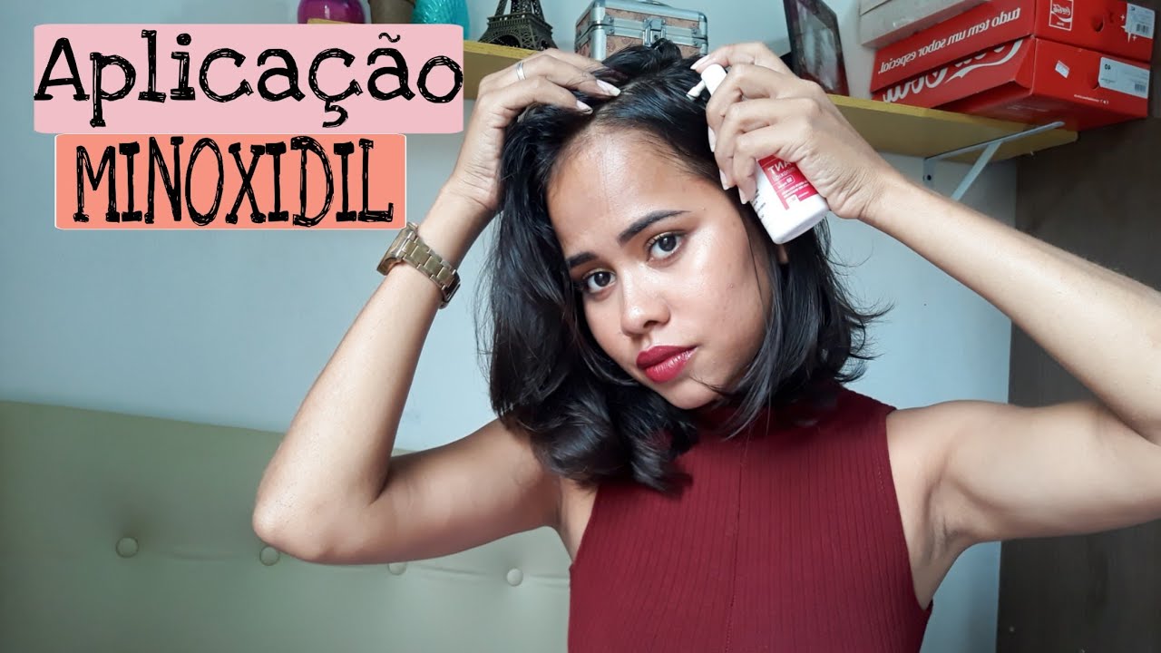 MINOXIDIL - Como faço aplicação