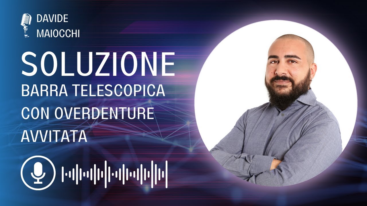 Maiocchi Soluzione barra telescopica con overdenture avvitata