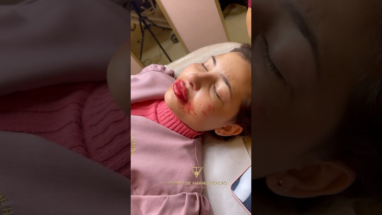 MICROPIGMENTA&Ccedil;&Atilde;O LABIAL 👄