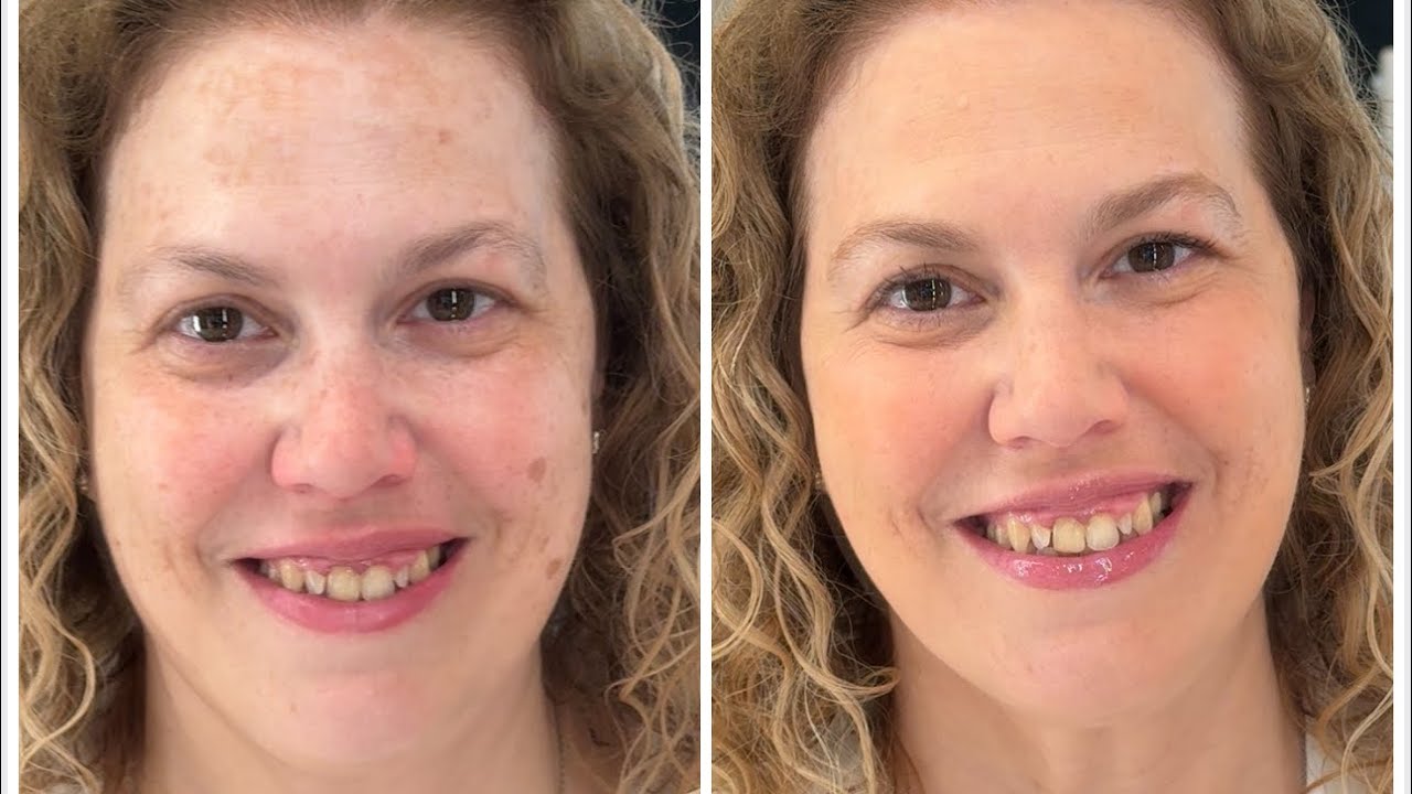 COMO CORREGIR LAS MANCHAS CON MAQUILLAJE (MELASMA, LENTIGOS). ANA APARICHI