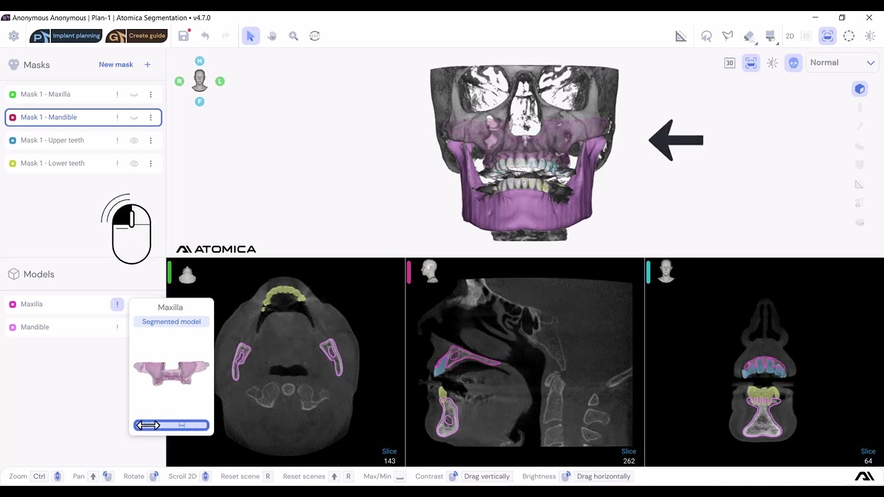 Vertical Listing and Transparency Control for Models and Masks