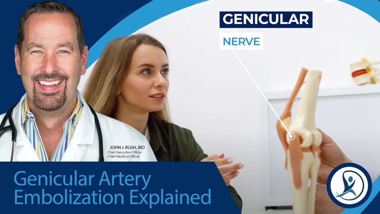 Genicular Artery Embolization: The Surprising Treatment for Stubborn Knee Pain