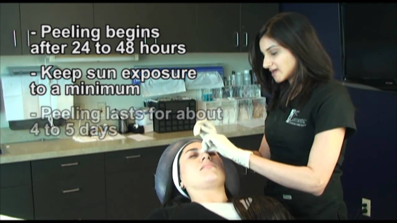vitalize peel SkinMedica acid peels facial treatments explained by Miam Beach dermatologist.