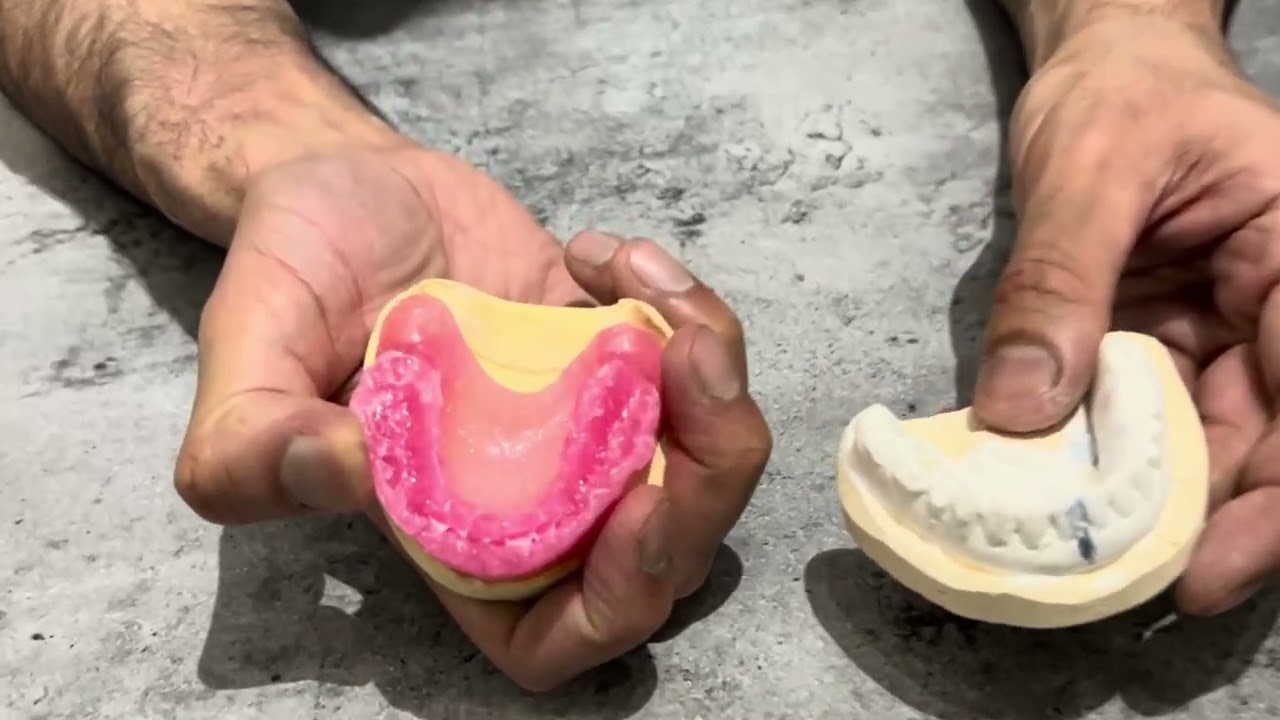 How Do I Make A Denture For Someone With No Teeth At All.