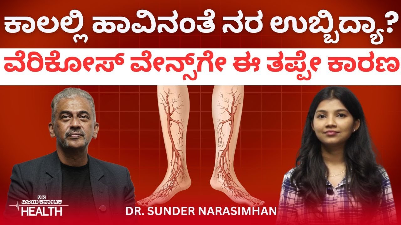 ವೆರಿಕೋಸ್ ವೇನ್ಸ್ (ನರಗಳ ಊತ) ಸಮಸ್ಯೆಗೆ ಶಾಶ್ವತ ಪರಿಹಾರವೇನು? | Dr.Sunder Narasimhan