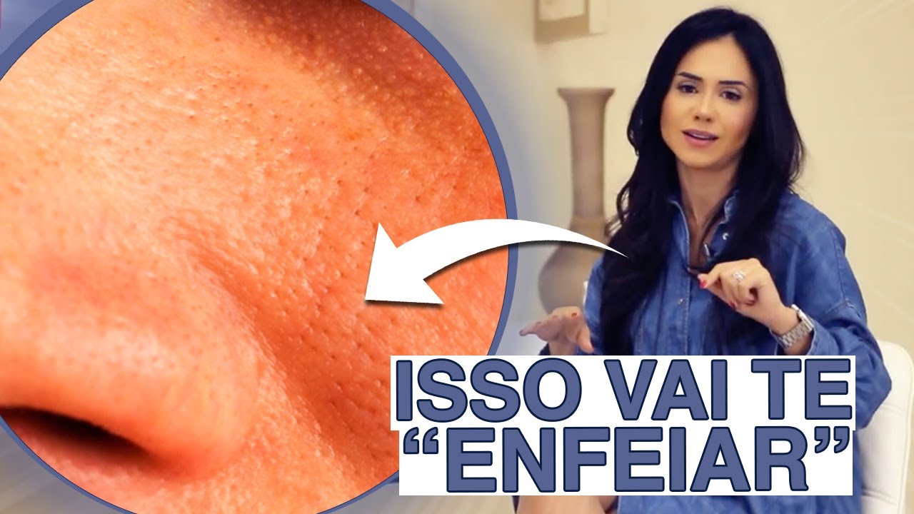 VOCÊ NÃO SABE, MAS OS POROS DILATADOS PODEM ESTAR TE 