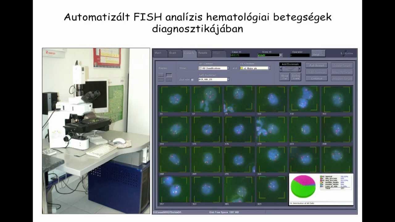 Szakmai anyag: Onkohematológiai molekuláris diagnosztika