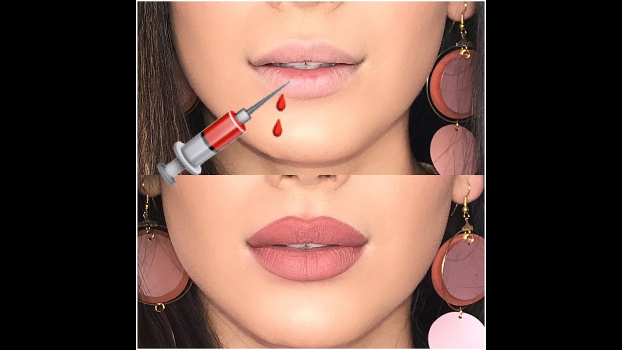 بزرگ کردن لب بدون تزریق؟!! | Sadaf Beauty