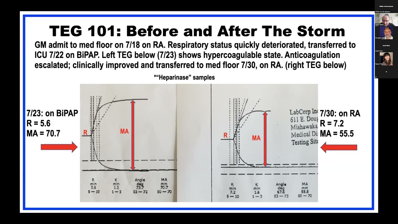 COVID-associated coagulopathy: The clot thickens (or not?)