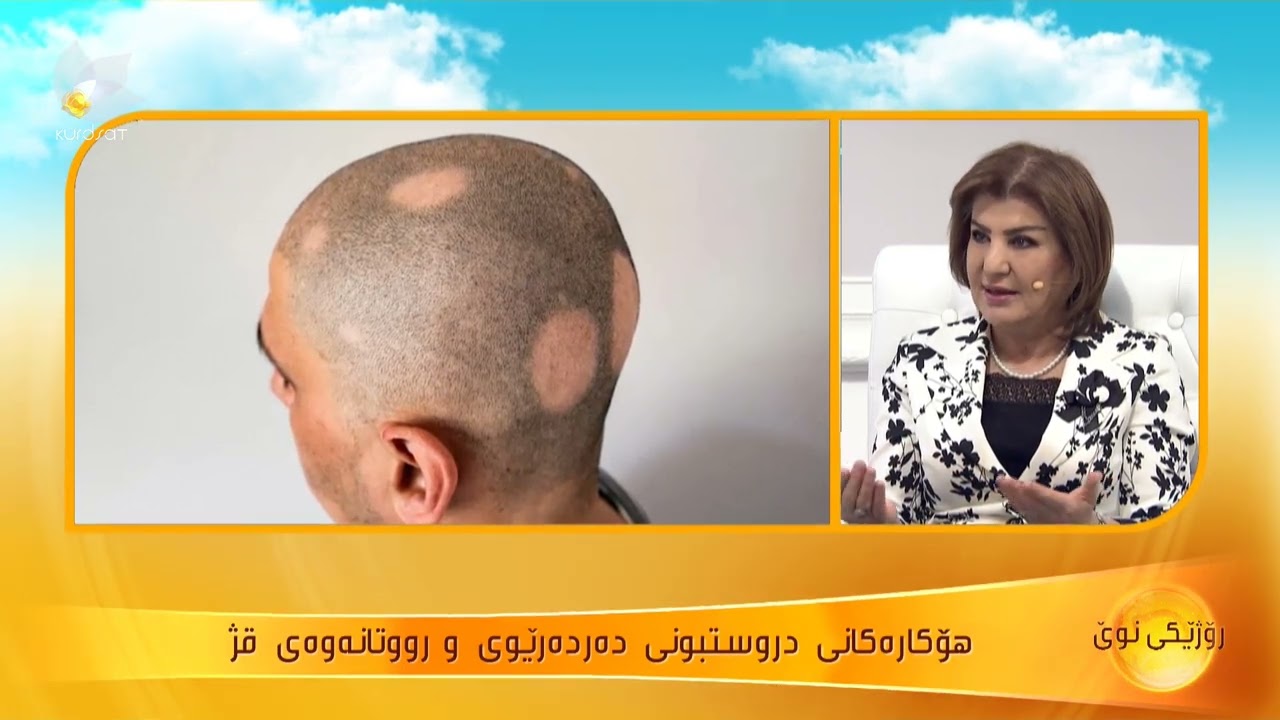 هۆكارەكانی دروستبونی دەردەرێوی و رووتانەوەی قژ