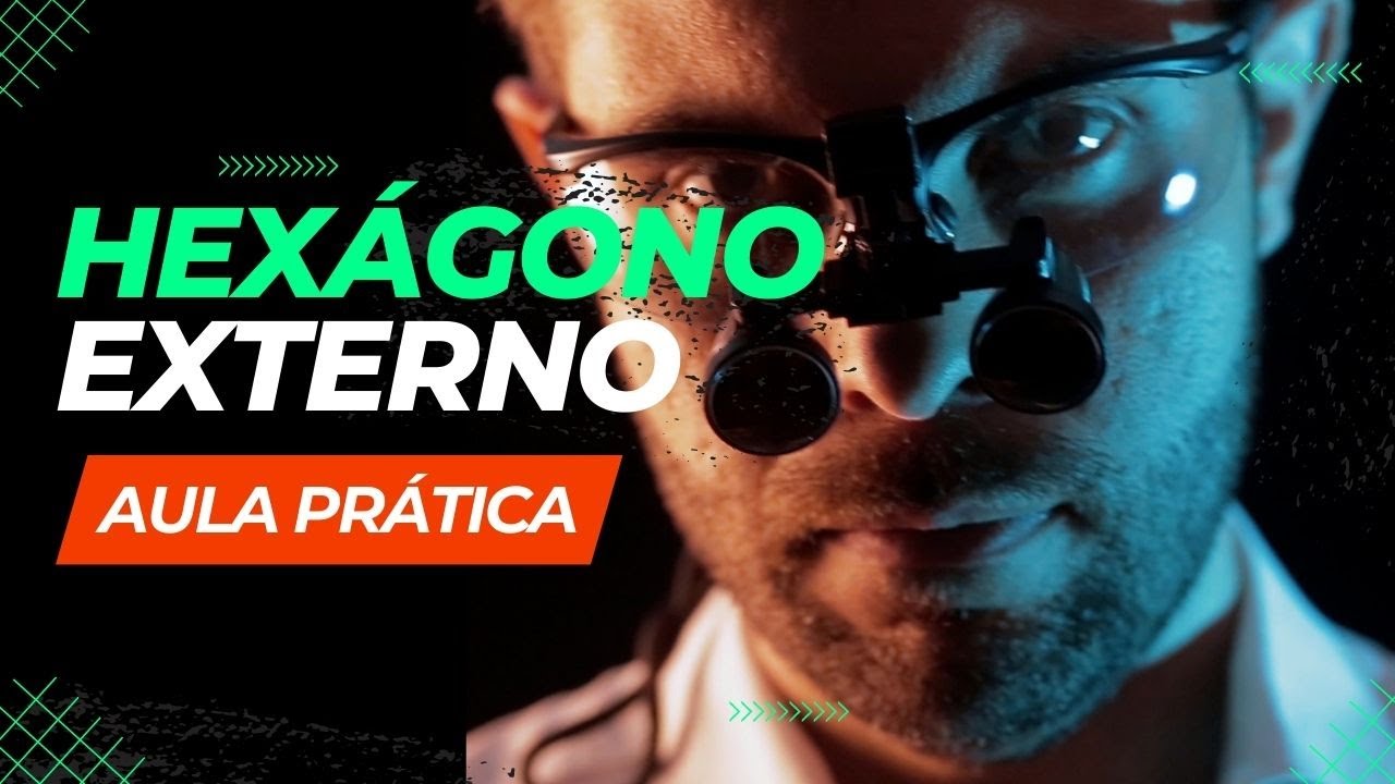Provisório Sobre Hexagono Externo - Aula Prática #odontologia #protesedentaria #implantedentario