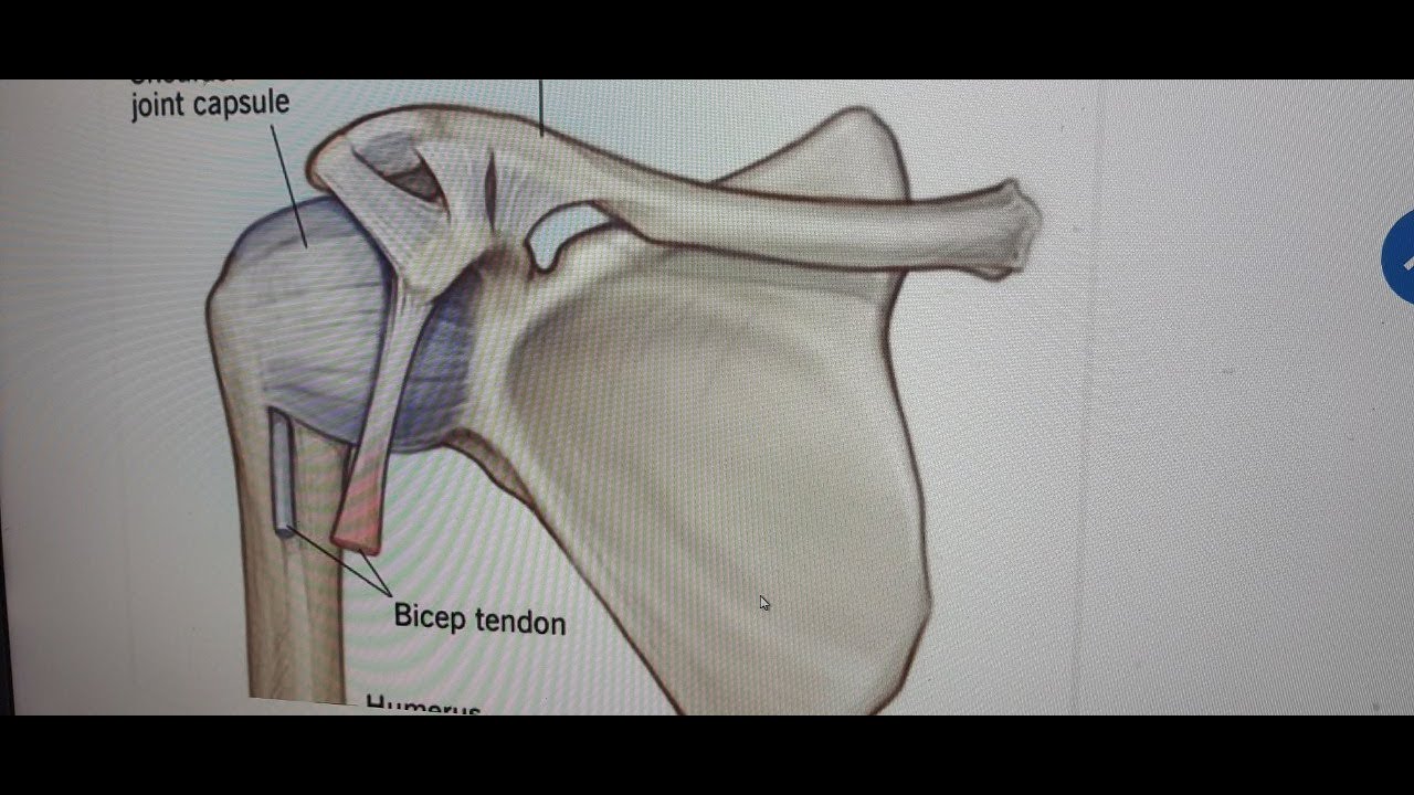 الجراحة العظمية د عيسىالجمل الكتف المتجمد FROZEN SHOULDER