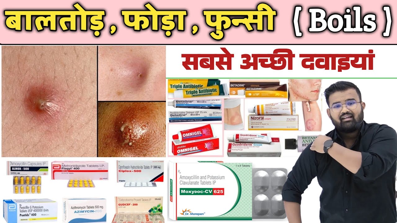 बालतोड़ , फोड़ा , फुंसी | Medicine | Skin Infection | Doctor | Pharmacy | Infection | Treatment 