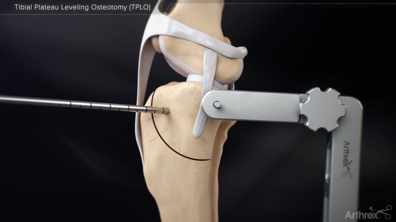 Tibial Plateau Leveling Osteotomy (TPLO)