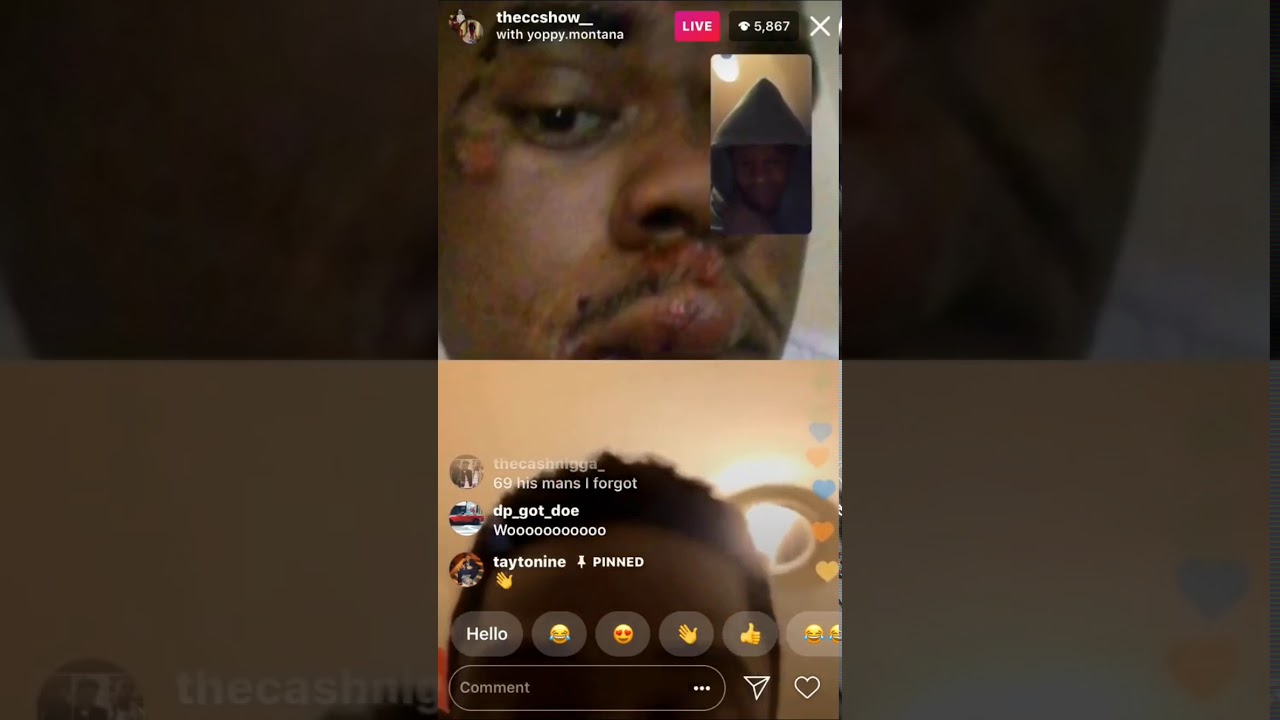 TheCcshow Live highbridge Vs Yoppy