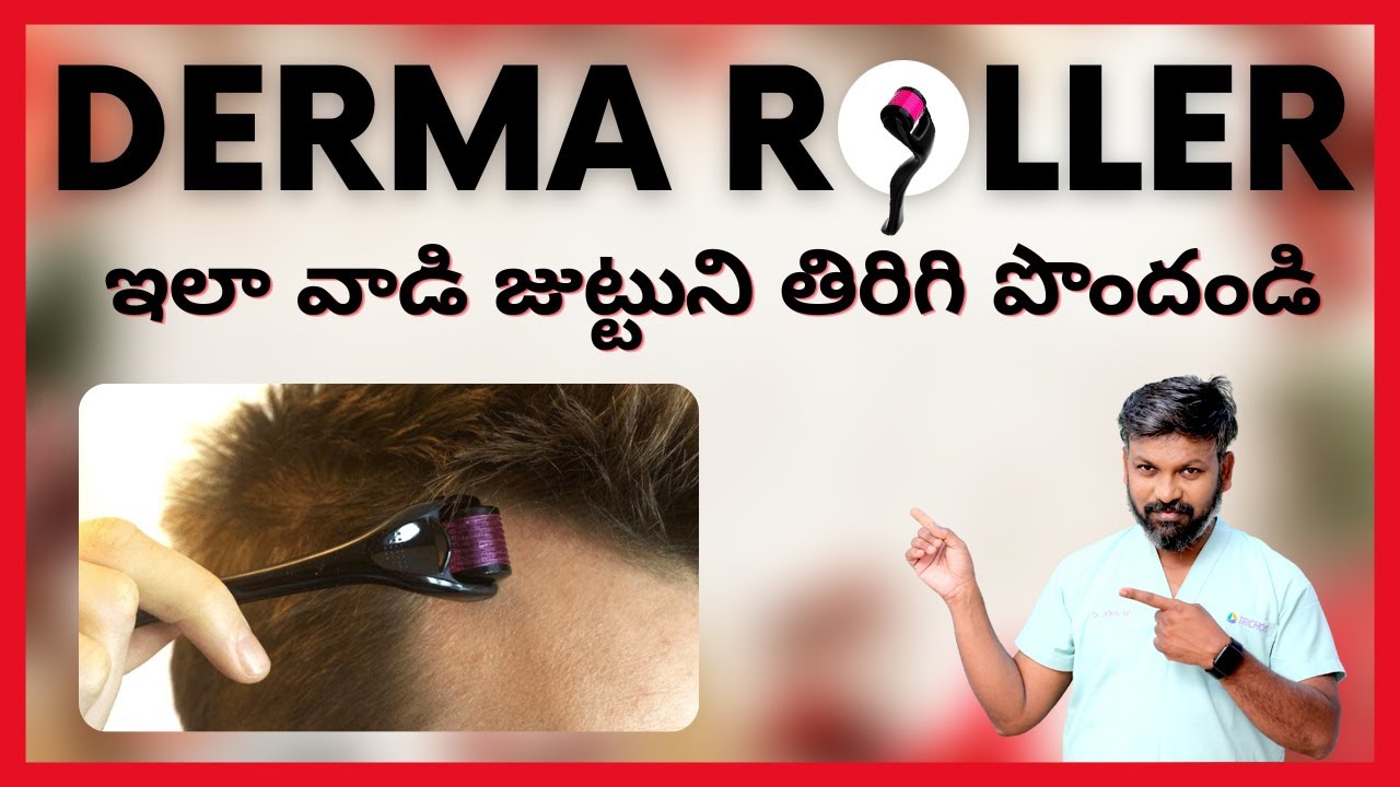 #AskDrJohnWatts | Derma Roller ని ఇలా వాడి జుట్టుని తిరిగి పొందండి | Hair Specialist Explains
