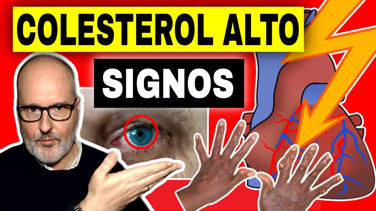SIGNOS (Y SÍNTOMAS) DE COLESTEROL ALTO (CAUSAS y QUÉ HACER)